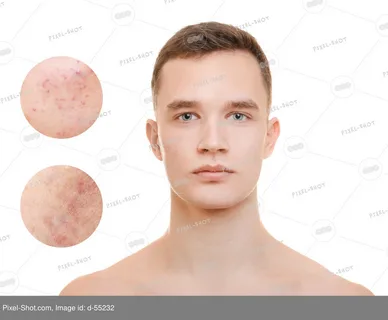 أهمية العناية بفروة الرأس في تجنب الصلع وتقليل تساقط الشعر