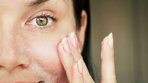 تقليل التهيج والاحمرار بواسطة ماسكات الوجه