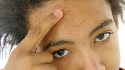 النصائح الغذائية لتقليل ظهور التجاعيد والخطوط الدقيقة