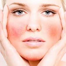 البشرة الدهنية تحمي الجلد من التلف الناتج عن الأشعة فوق البنفسجية