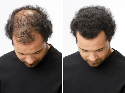 كيفية اختيار منتجات العناية بالشعر المناسبة لتقليل دهون فروة الرأس