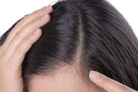 أهمية التغذية الصحيحة في علاج تساقط الشعر للنساء اللواتي يرضعن