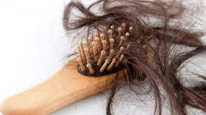 تساقط الشعر للنساء: الأسباب والعلاج