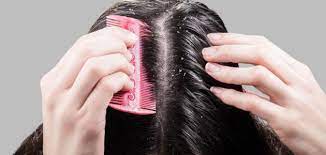 تأثير الهرمونات على تساقط الشعر بعد الولادة وكيفية علاجه