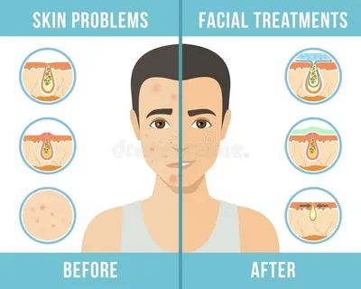 منتجات التجميل المفضلة للحد من الرؤوس البيضاء